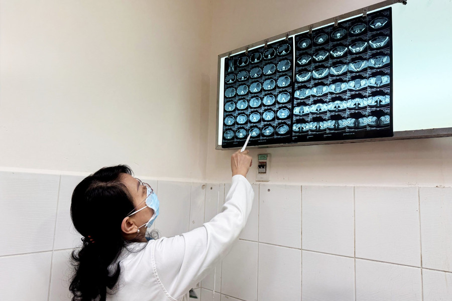 Bác sĩ đọc phim MSCT trước và sau điều trị của bệnh nhi.