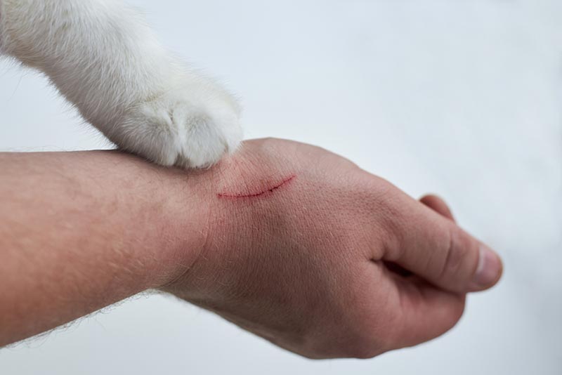 Bé Trai 11 Tuổi Ở Lào Cai Tử Vong Nghi Bệnh Dại Sau Khi Bị Mèo Cào 1 Dại sau khi bị mèo cào - Hình ảnh minh họa