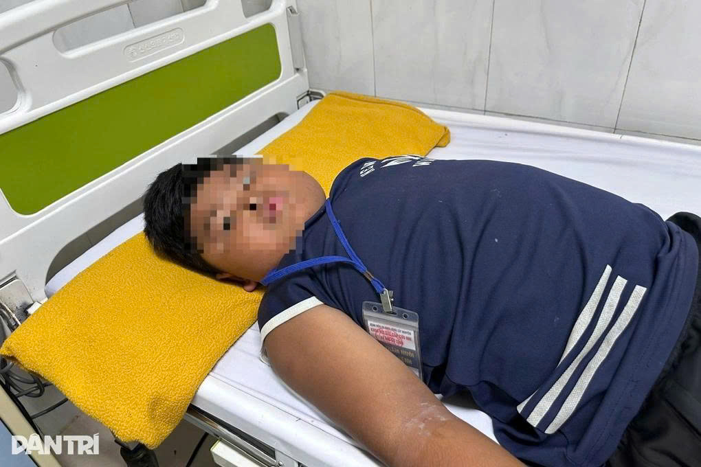 Bé trai 9 tuổi cũng bị ong tấn công khi đang hái trái cây (Ảnh: Thúy Diễm).