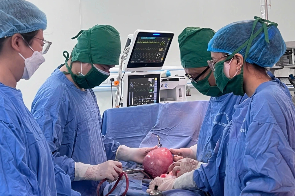 Phẫu thuật thành công khối u xơ tử cung nặng 3kg tại Quảng Nam 1 Khối u xơ tử cung nặng 3kg (Ảnh bệnh viện cung cấp).