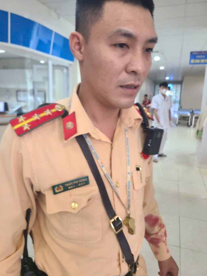 Người chiến sĩ công an bế bé gái gặp nạn đến bệnh viện, hành động đẹp lay động lòng người 3 Anh công an với chiếc tay áo dây đầy máu đang lo lắng cho bé gái