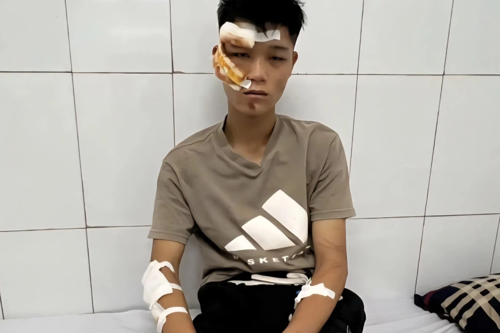 Khởi tố vụ án “thông chốt” bảo vệ A80: Hai thanh niên 18 tuổi bị điều tra tội giết người 1 Đối tượng Nguyễn Văn Quân (Ảnh: Đ.T.).