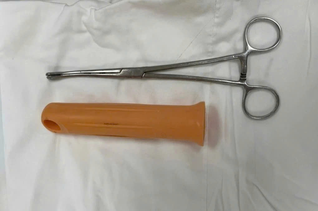 Nam thanh niên nhập viện vì cán cây lau nhà dài 15cm mắc kẹt trong hậu môn 2 Cán cây lau nhà dài 15cm sau khi được gắp ra (Ảnh: BV).