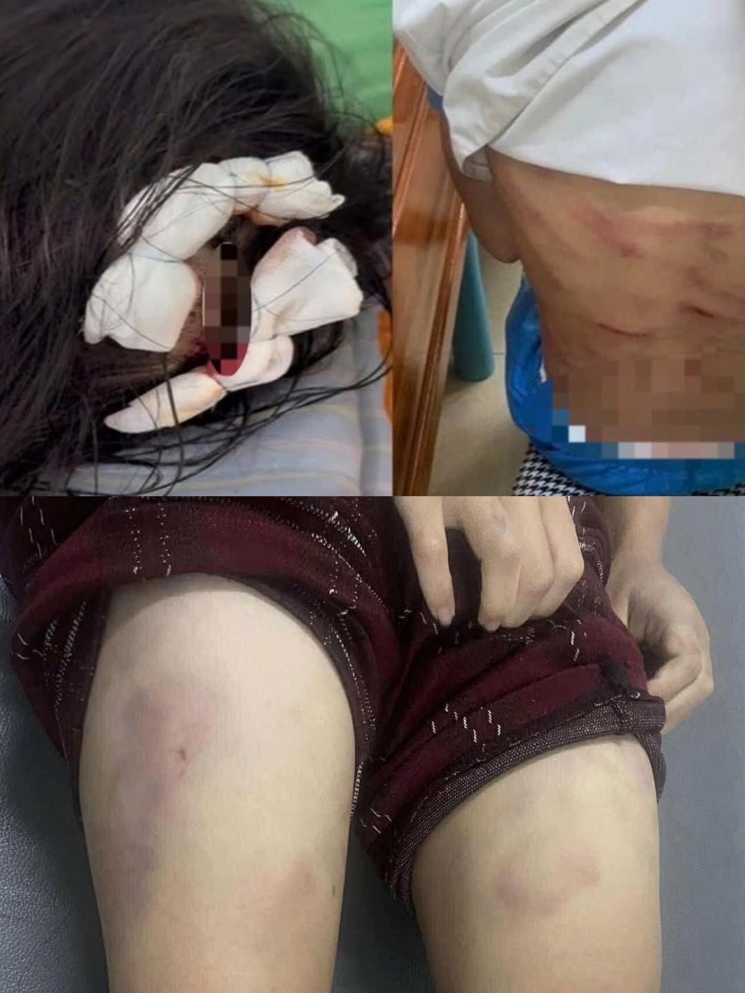 Bắt giữ khẩn cấp đối tượng bạo hành con riêng của vợ tại Hà Tĩnh 2 565653046 122272808138081724 5619857962293481211 n