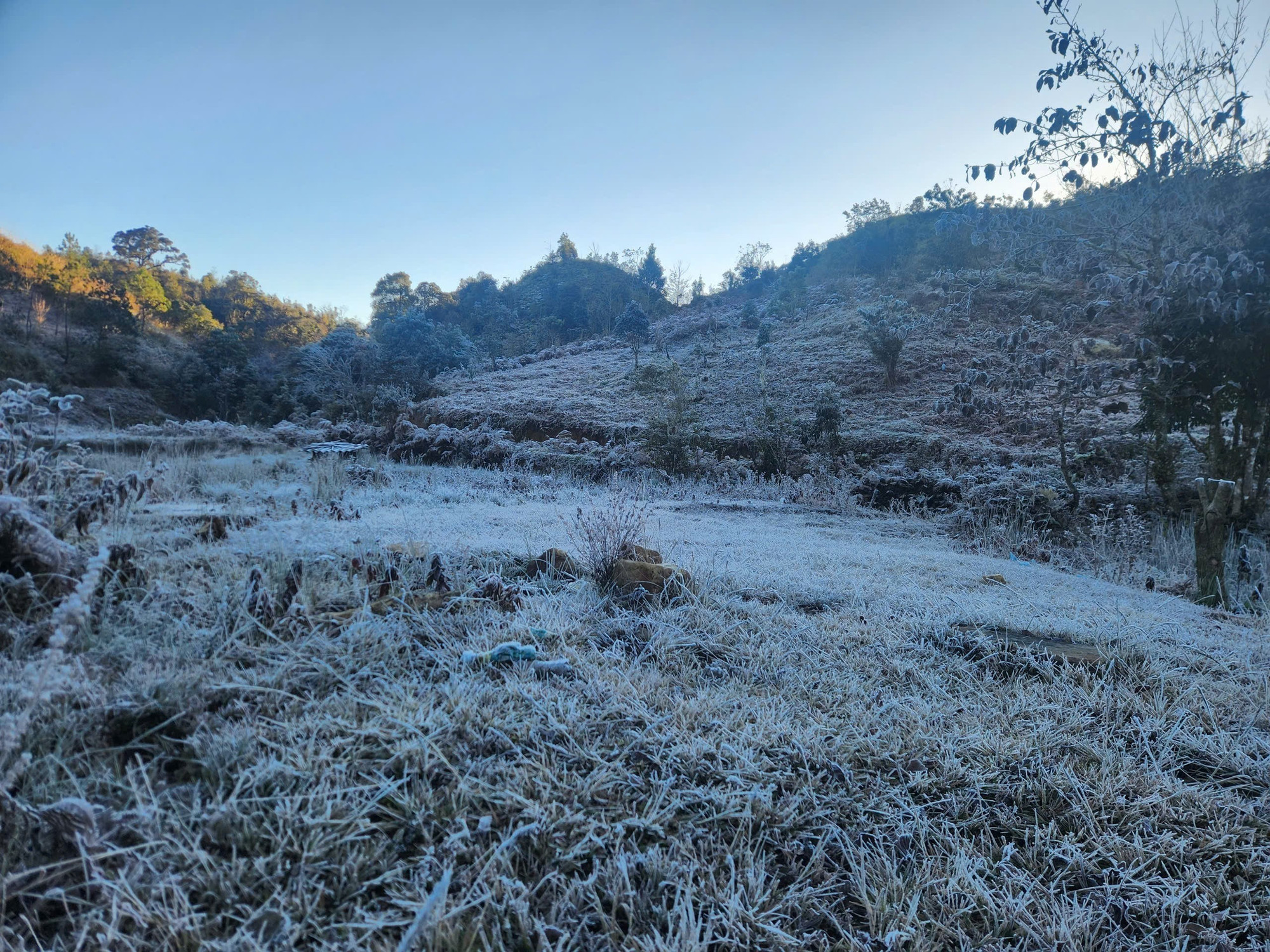 bang gia y ty lao cai 3