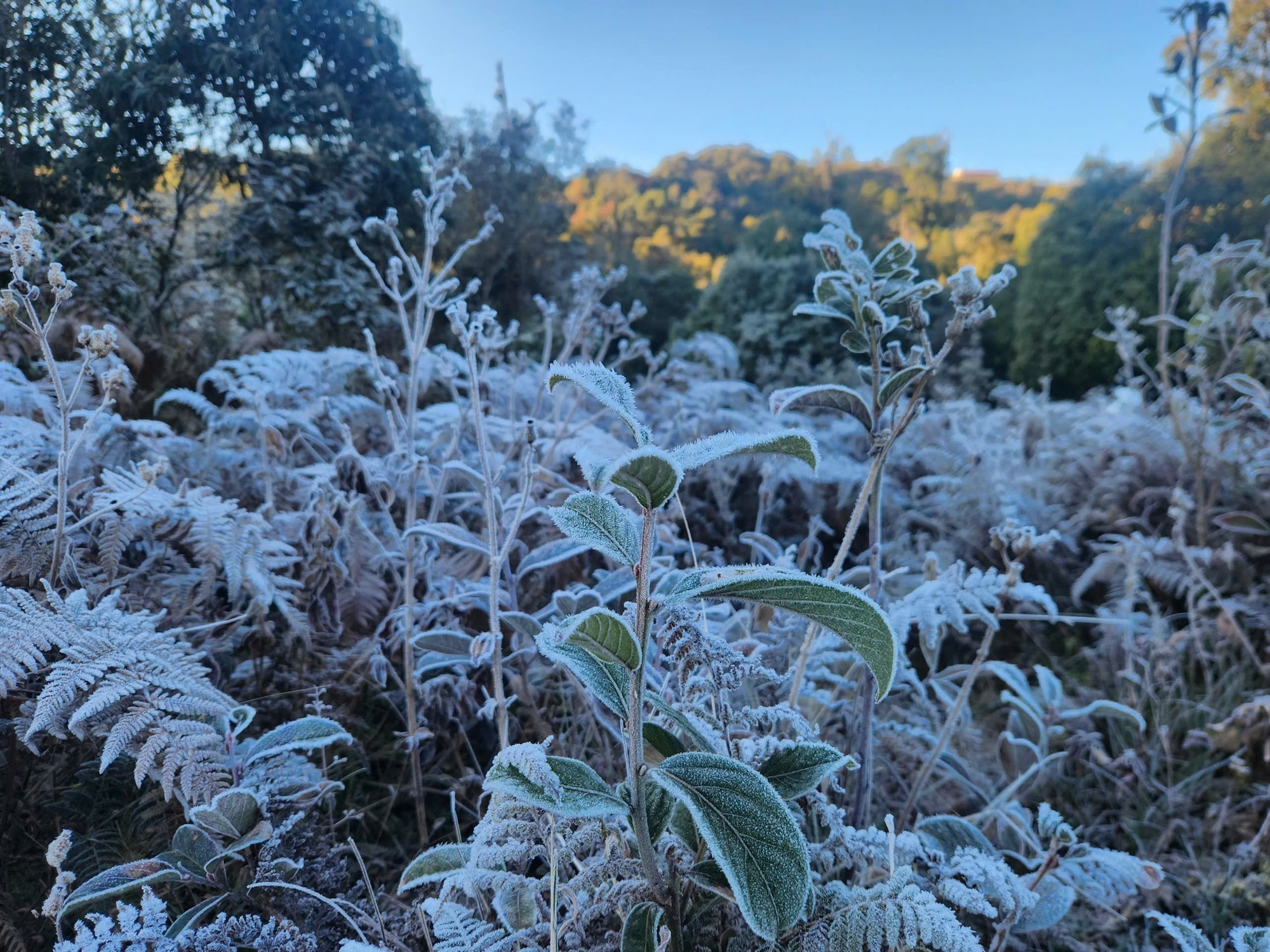 bang gia y ty lao cai 4