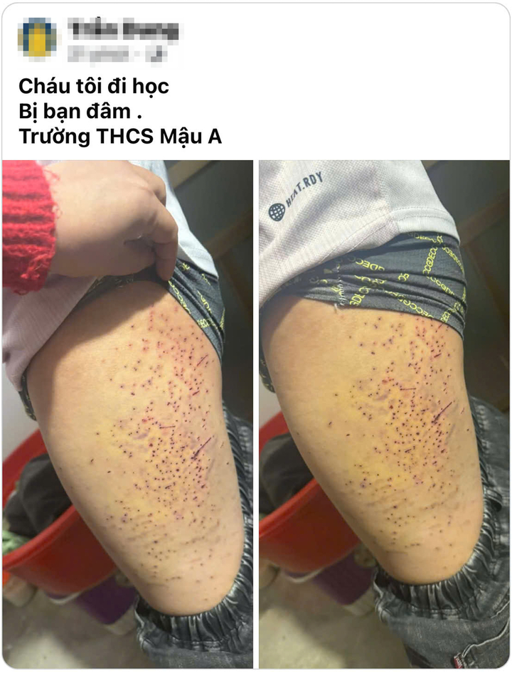 lao cai xac minh hoc sinh dung vat nhon dam ban thcs mau a 10170913 1773287428910 1773287429547398532021