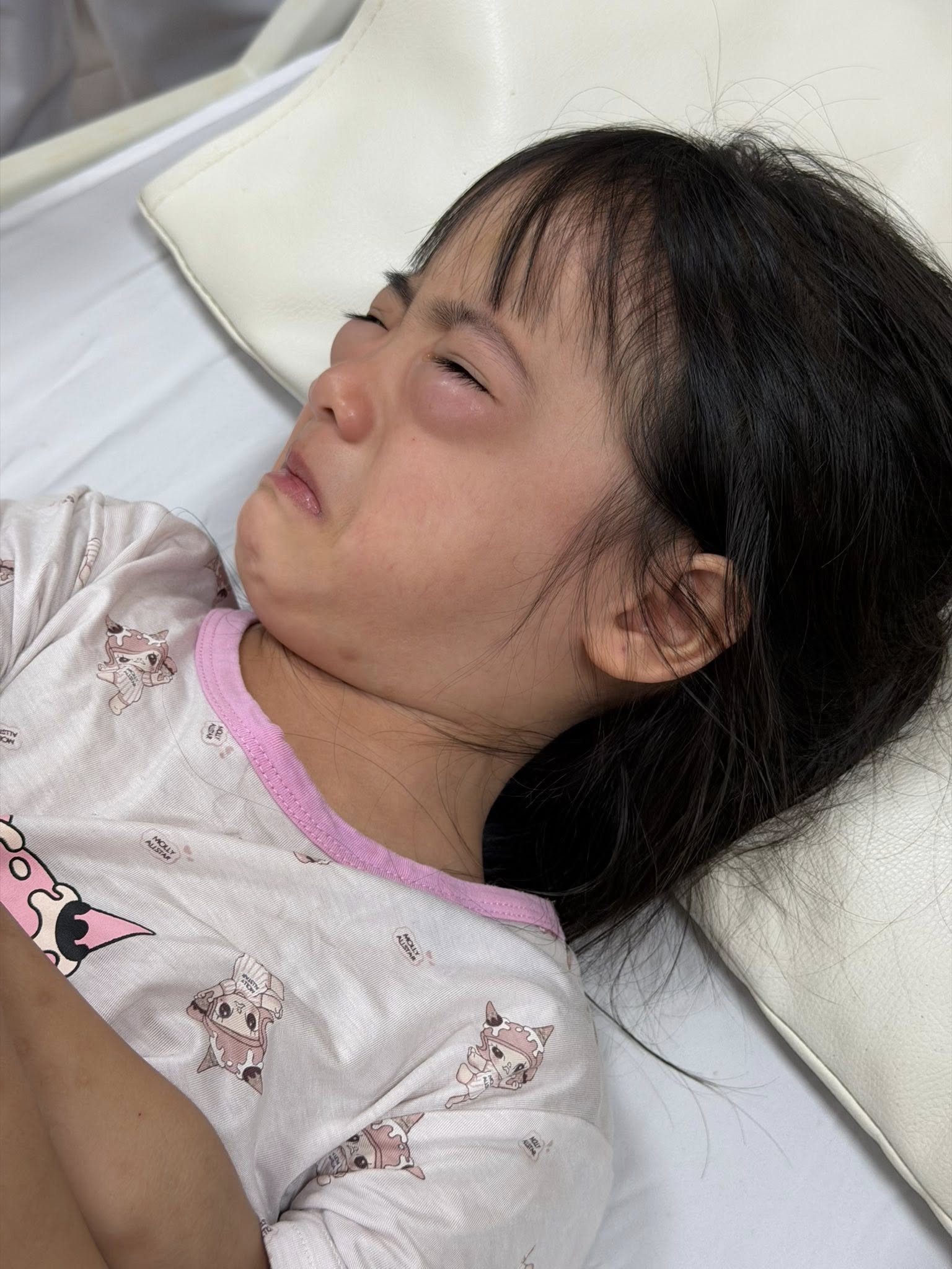 Cảnh báo dị ứng từ trò chơi thổi bong bóng trẻ em 1 Tình trạng của bé khi nhập viện