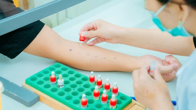 Nguy cơ khó lường từ dị ứng thuốc và thức ăn 1 Test dị ứng cho bệnh nhân.