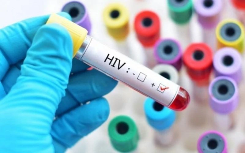 Sửa quy định về cấp giấy chứng nhận bị phơi nhiễm với HIV, bị nhiễm HIV do tai nạn rủi ro nghề nghiệp. (Ảnh minh họa)